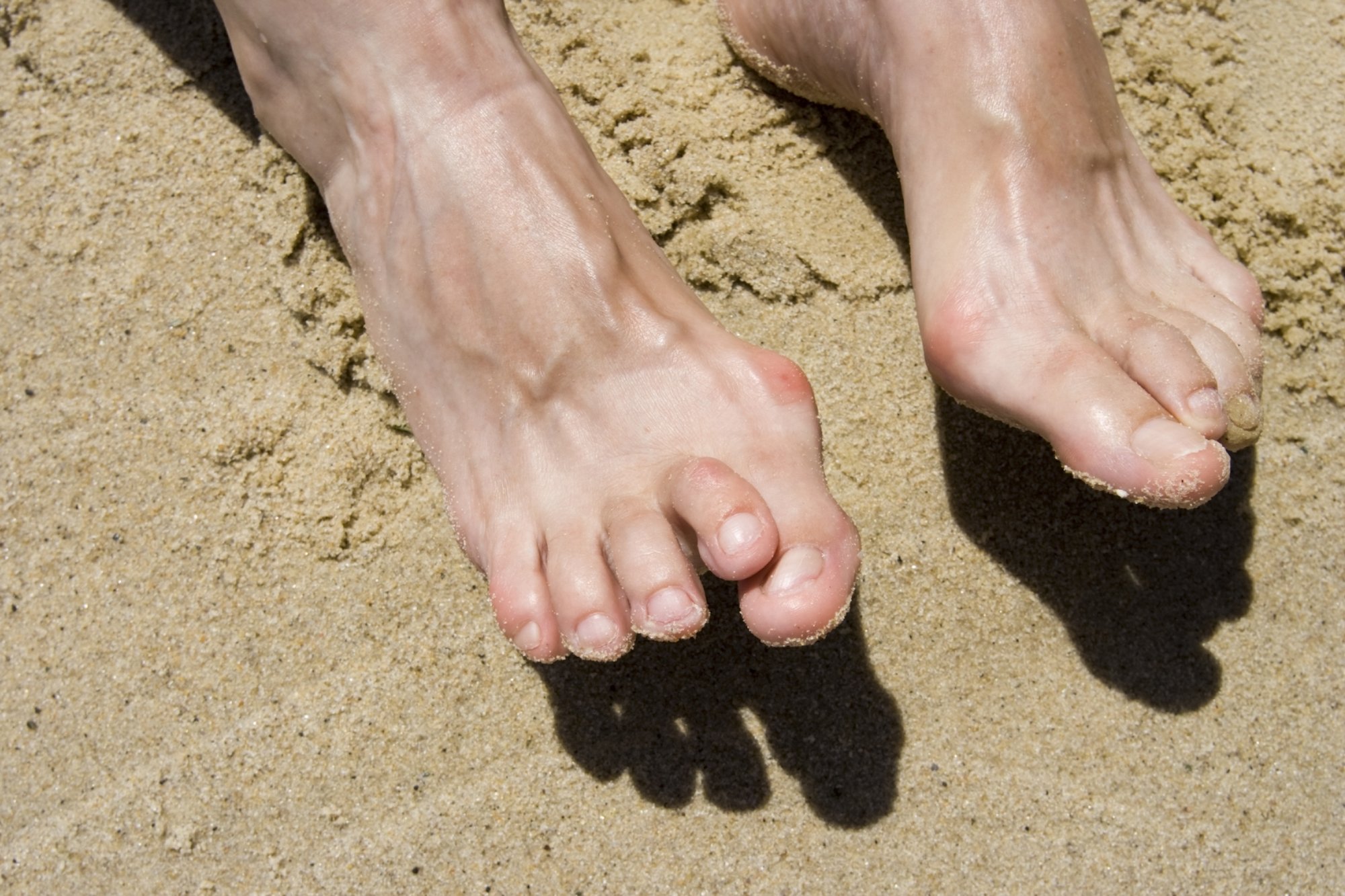 Man Moving Hammertoe Through Sand