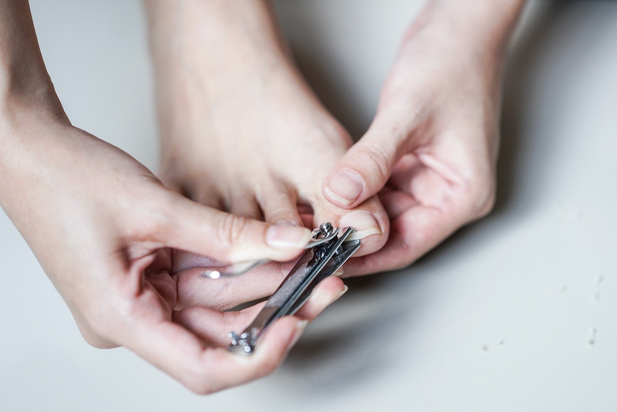 Young Woman Clipping Ingrown Toenail