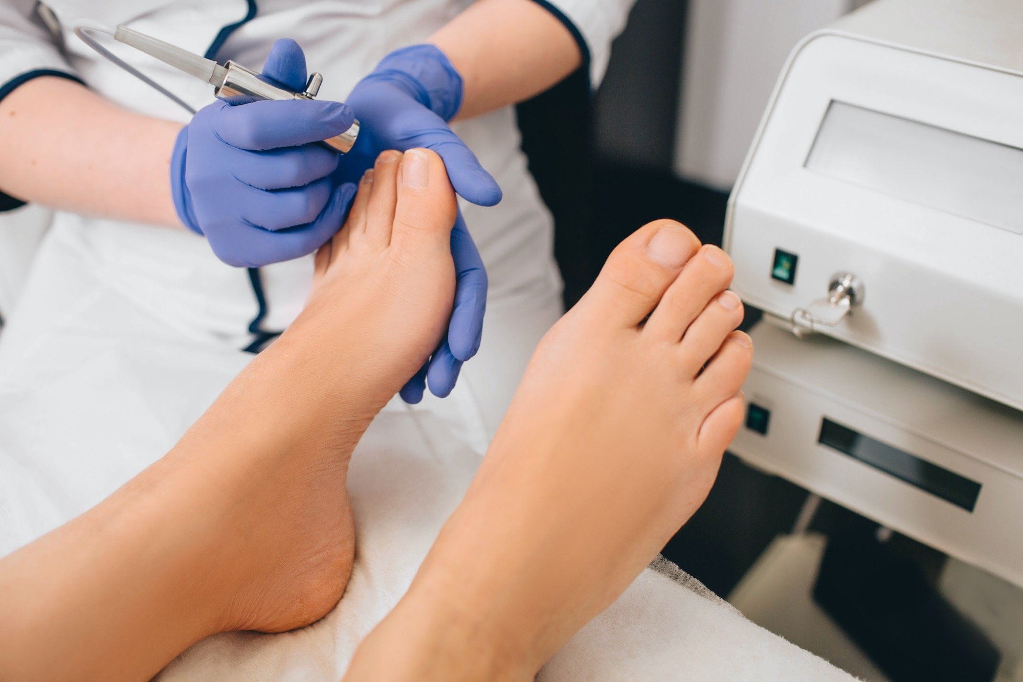 Young Patient in Podiatry Office Addressing Nail Fungus